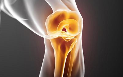 膝关节炎的五个表现