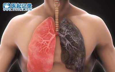 可以清肺的几种食物