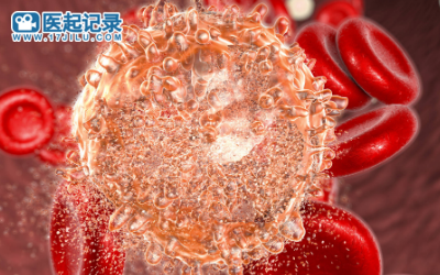 治疗成人复发或难治性B细胞急性淋巴细胞白血病药物源瑞达/纳基奥仑赛在中国获批