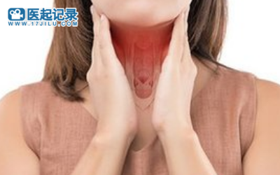 缓解嗓子疼的六种方法