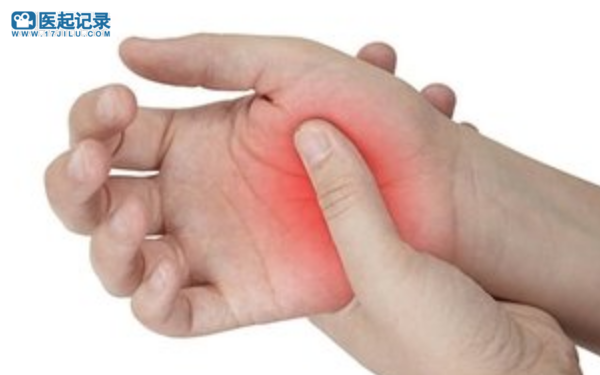 预防压力性损伤OptiView透明伤口敷料在美国上市